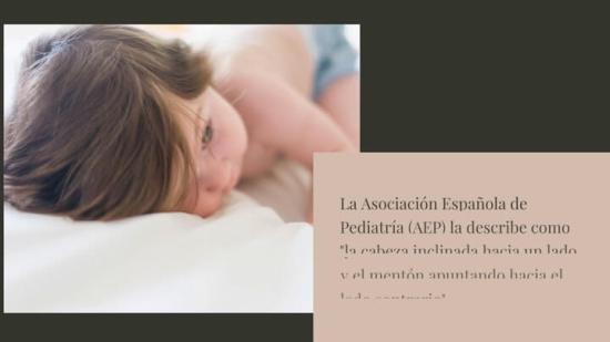 Tortícolis congénita: qué es y cómo afecta a los bebés