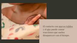 Erupciones en la piel de bebés y niños pequeños: guía útil por edades