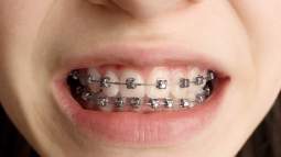 iStock-1316114867