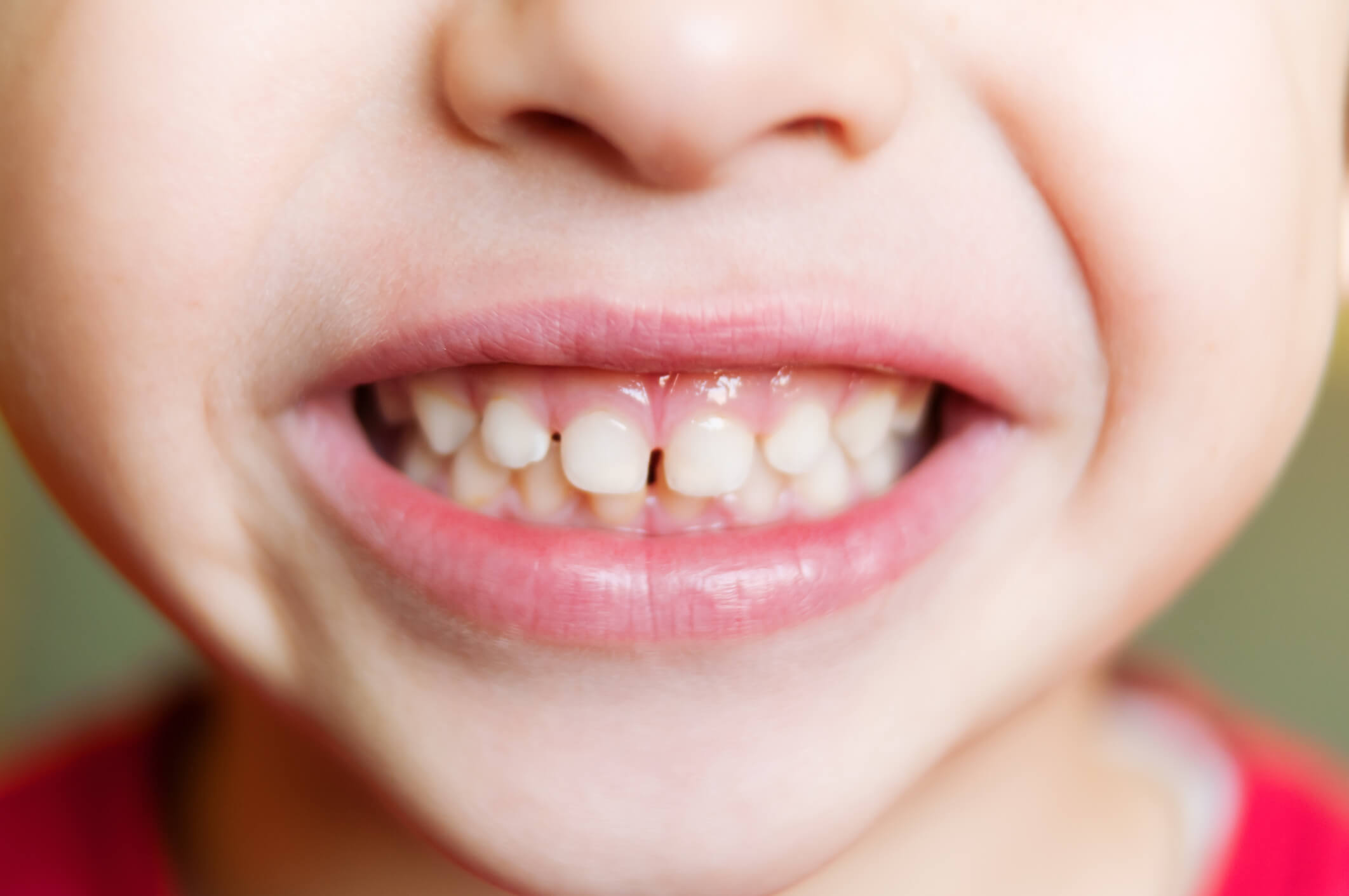 iStock-508182165