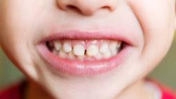iStock-508182165