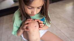 closeup-little-girl-holding-her-bruised-injured-damaged-knee-with-her-hands