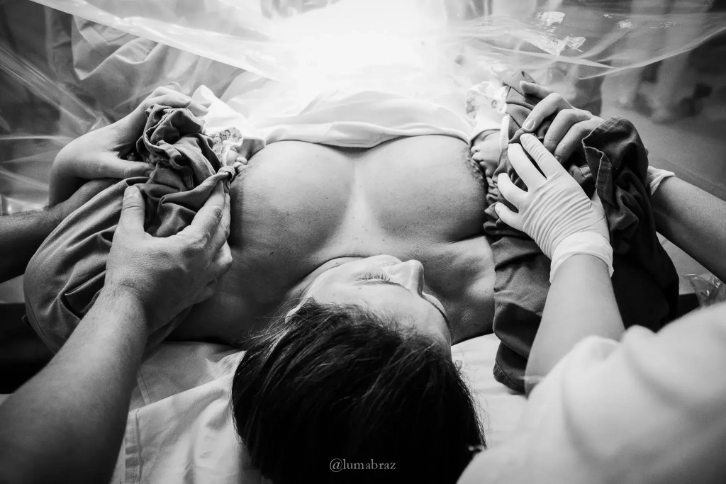 Una de las mejores fotografías de partos