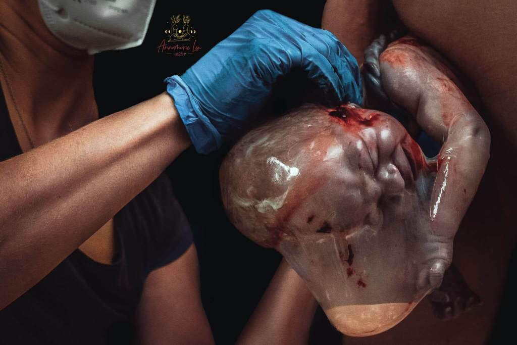 Una de las mejores fotografías de partos