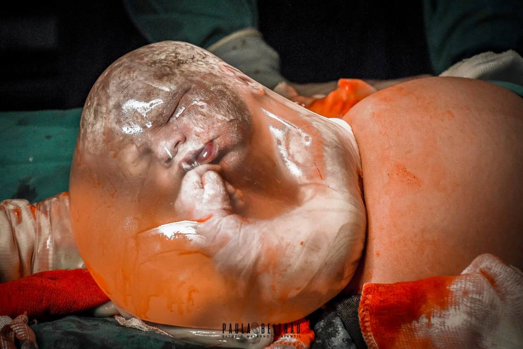 Una de las mejores fotografías de partos (International Association of Professional Birth Photographers)