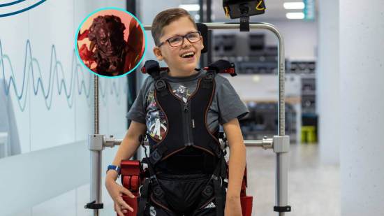 Jorge, con el exoesqueleto pediátrico de Marsi Bionics