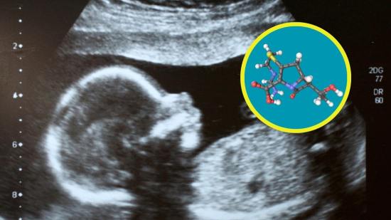 La historia detrás del primer uso prenatal de un medicamento para la atrofia muscular espinal