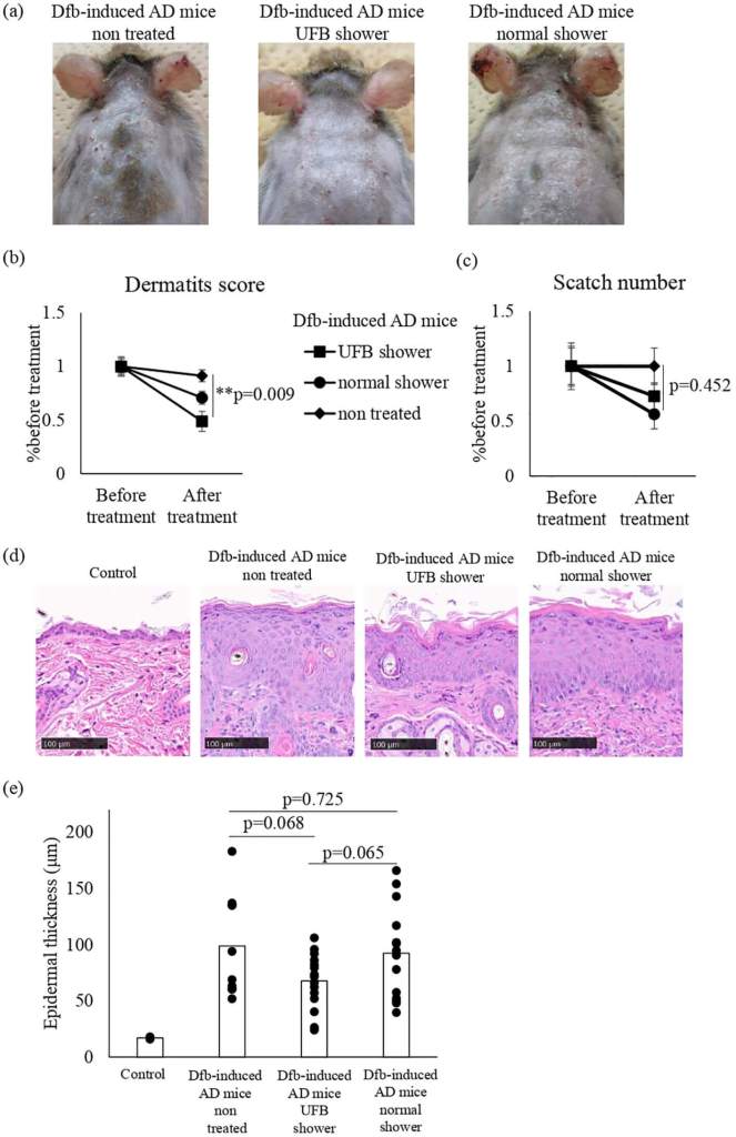 Cambios en la puntuación de dermatitis, número de rasguños y grosor de la piel en ratones con DA inducida por Dfb después del tratamiento de ducha. (A) Los ratones fueron tratados con una ducha UFB o una ducha normal durante 7-14 días.