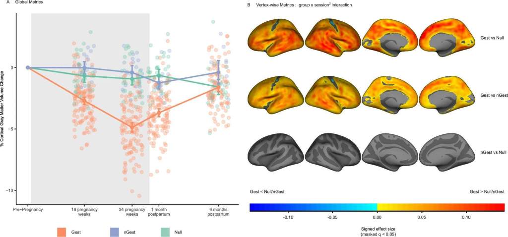 Fig. 1: Trayectoria longitudinal del volumen de materia gris cortical a lo largo del embarazo y el posparto ( N  = 179).