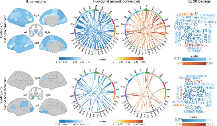 Figura 3 Los patrones de volúmenes cerebrales y conectividades de redes funcionales contribuyen a las dimensiones del sueño vinculadas