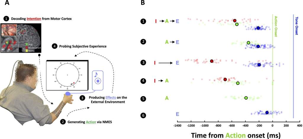 Fig 1. Vinculación temporal entre intención y acción. (A) Registro neuronal y configuración experimental. Arriba: Imágenes por resonancia magnética (IRM) ponderadas en T1 que muestran la superposición entre las áreas de movimiento del brazo/mano (de la IRM funcional) en la corteza motora primaria y la colocación de la matriz de registro indicada por la tomografía posoperatoria. Abajo: Representación de la configuración experimental, donde el usuario de BMI (pixelado para mayor privacidad) vio un reloj con una sola manecilla (punto rojo) que realizaba un ciclo completo en 2560 ms y tuvo que indicar cuándo intentó moverse por primera vez, cuándo se movió (acción) o cuándo se produjeron tonos (efecto). (B) Resultados conductuales. 