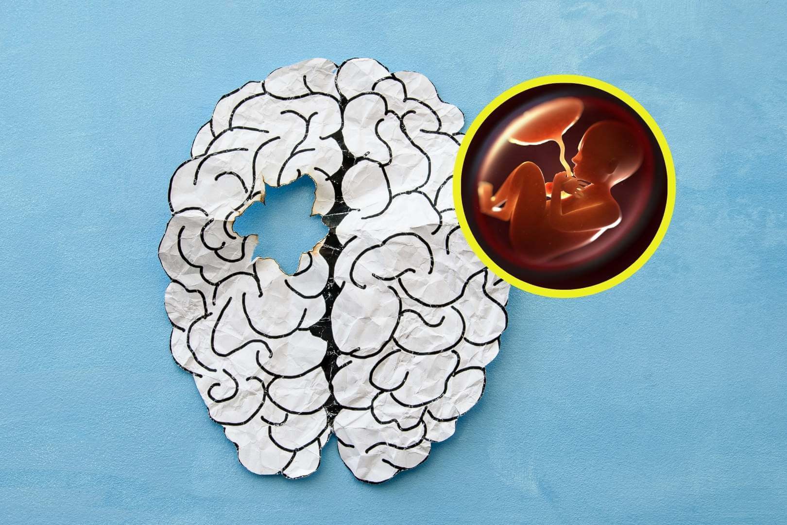 La placenta, clave inesperada en el origen de la esquizofrenia y otros trastornos mentales