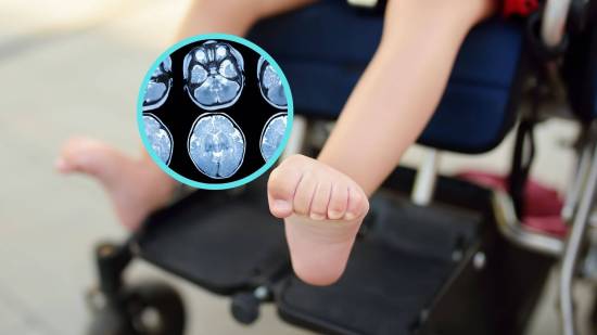 La terapia génica transforma el pronóstico de una enfermedad neurológica infantil rara, revela nuevo estudio