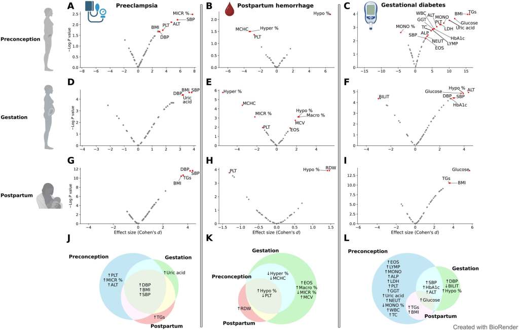 Fig. 6. Pruebas con desviaciones significativas de embarazos saludables en preeclampsia, diabetes gestacional y HPP. ( A a I ) Gráficos de Volcán del valor de p -log (corregido por FDR) frente al tamaño del efecto para cada prueba en cada momento. Consulte los nombres completos de las pruebas en la tabla S1. Las pruebas significativas están marcadas con un punto rojo y su nombre (Métodos). ( J a L ) Diagramas de Venn que muestran las pruebas significativas en los períodos preconcepcional (azul), gestacional (verde) y posparto (rojo) para cada complicación. Creado con BioRender.