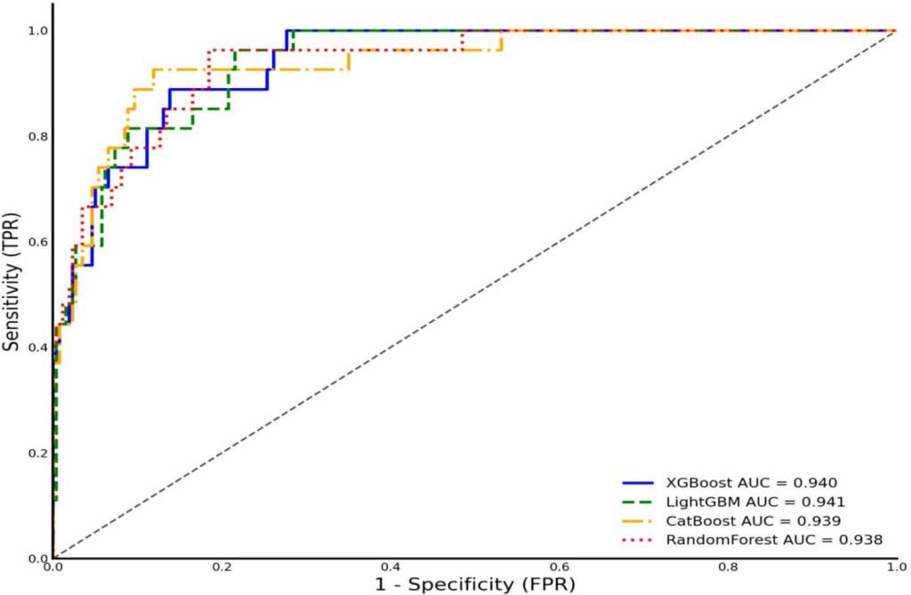 Figura 2. Rendimiento según la curva ROC de ML (Random Forest, XGBoost, LightGBM y Catboost) para la predicción de LBW
