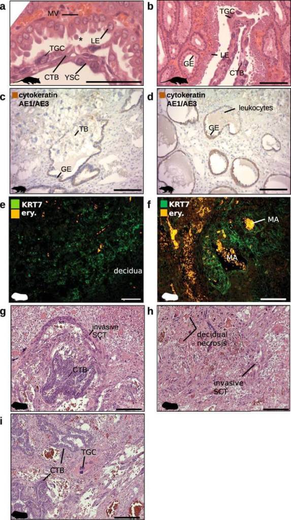 Datos ampliados Fig. 4 Identificación histológica adicional de los tipos de células placentarias. a - b . La interfaz feto-materna de la zarigüeya, que muestra 3 capas de endodermo del saco vitelino (YSC), citotrofoblasto (CTB) y nudos sincitiales (TGC), en aposición con el epitelio luminal materno (LE) que produce cuerpos secretores (*); el epitelio glandular materno (GE) se encuentra estrechamente debajo del lumen. c - d . El frente de invasión de tenrec, donde el trofoblasto invade glándulas llenas de moco, erosionando el epitelio glandular (GE) inmunorreactivo para la tinción de pancitoqueratina (CK AE1/AE3). e - f . Trofoblasto KRT7+ en el conejillo de indias que rodea el estroma decidual (izquierda) y las arterias maternas (MA; derecha). g - h . El sinciciotrofoblasto invasivo (SCT) en el conejillo de indias emana del citotrofoblasto subplacentario (izquierda) y se extiende hacia el estroma donde se desarrollan parches necróticos (derecha). i . Se observó una célula gigante del trofoblasto en la subplacenta de un cobaya (próxima al CTB subplacentario), pero estas células no se detectaron mediante secuenciación basada en gotas. Barras de escala: 200 μm. Siluetas de PhyloPic bajo licencia Creative Commons: tenrec, Yan Wong ( CC0 1.0 ); macaco, Jane Whitehouse ( CC0 1.0 ); ratón, Michael Keesey ( PDM 1.0 ).