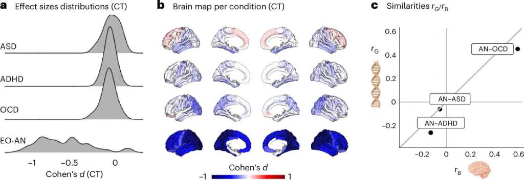 Fig. 3: Similitudes del patrón cerebral EO-AN con condiciones psiquiátricas adicionales. 